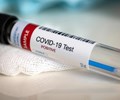 Xác nhận ca mắc COVID 19 lâu nhất thế giới 