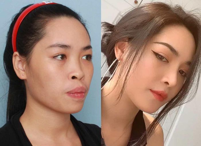 Hot girl thẩm mỹ Nam Định có nhan sắc đỉnh cao sau giảm cân - Hình 2