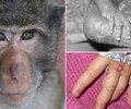 6 biện pháp phòng chống dịch bệnh đậu mùa khỉ mà bạn cần biết 