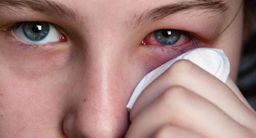 4 loại  bệnh có  thể  mắc  phải  khi  mắt  nháy giật liên tục